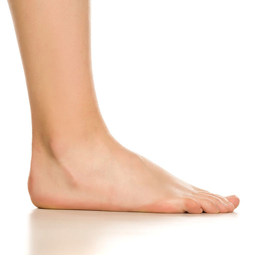 ¿Qué significa tener los pies planos?