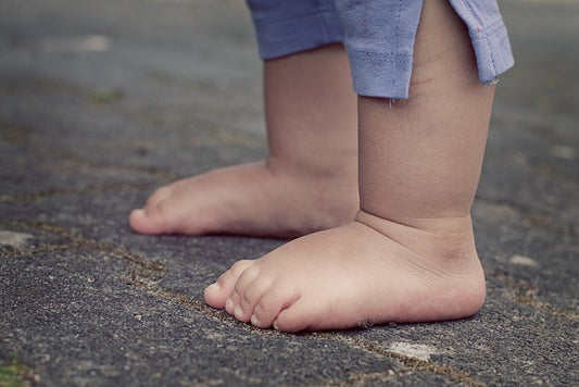 Por qué no poner zapatos a los bebés