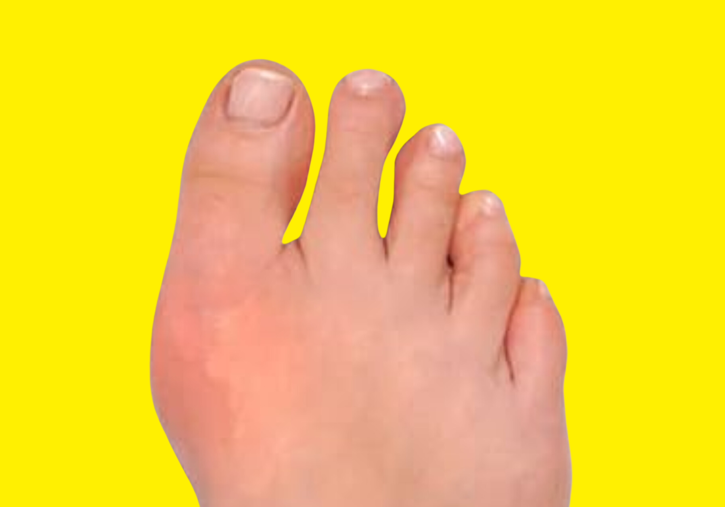 La mentira del barefoot