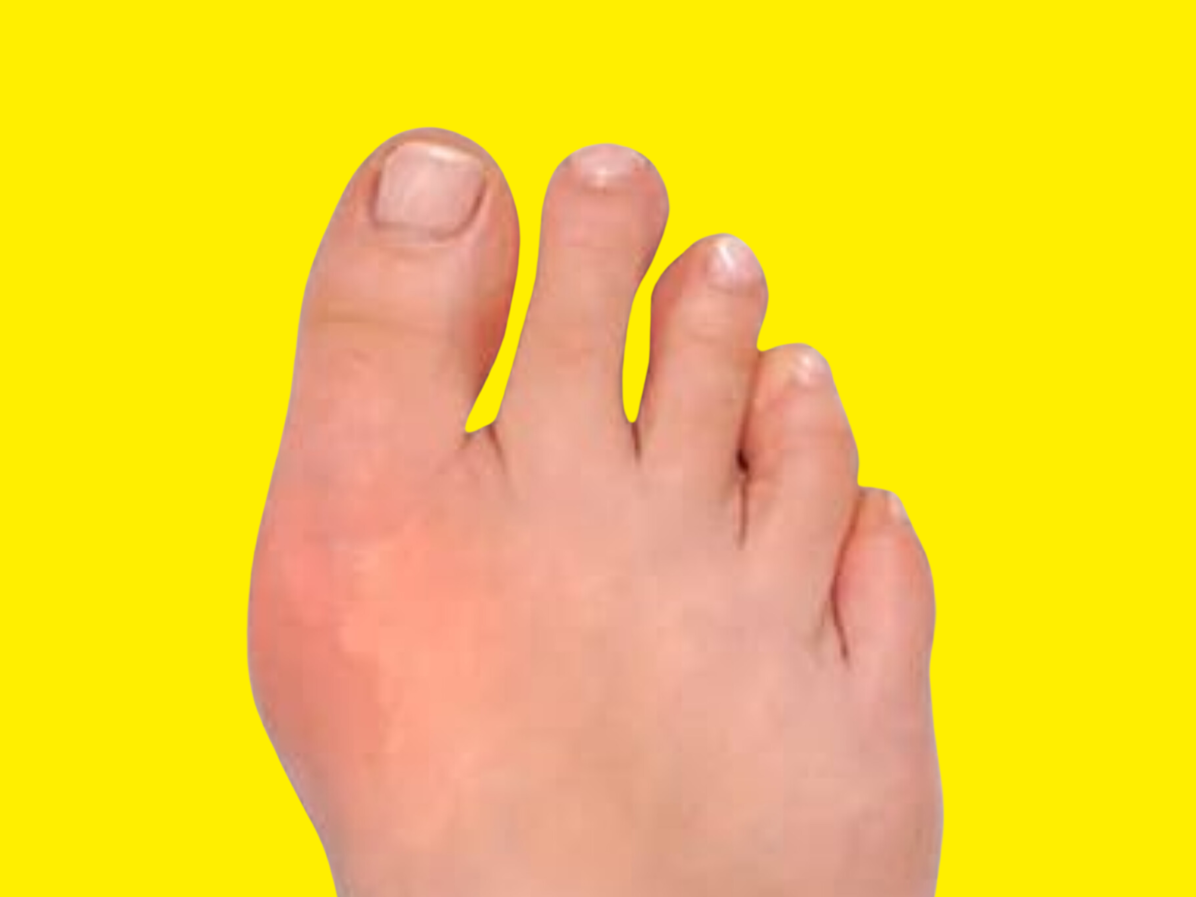 La mentira del barefoot