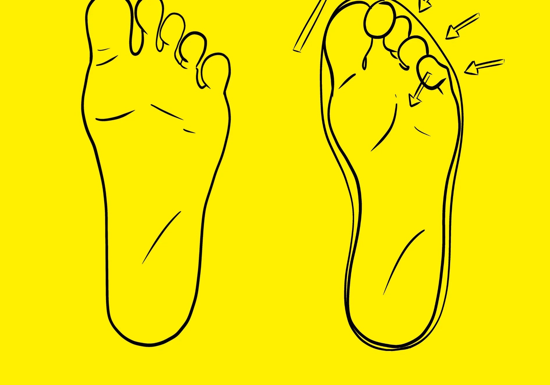 Barefoot antes y después