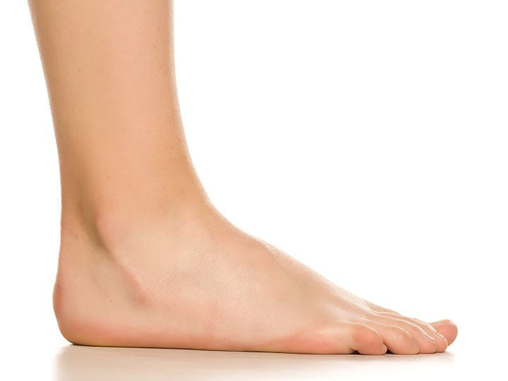 ¿Qué significa tener los pies planos? - Barefoot You